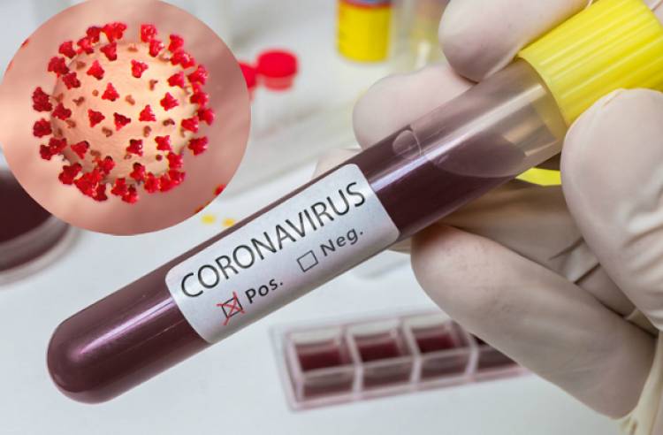 Արցախում գրանցվել է կորոնավիրուսի 15 նոր դեպք