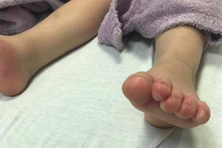 Ռոստովի մարզում երեխան ոտքերի այրվածքներ է ստացել ու այրել ծնողների ավտոտնակը