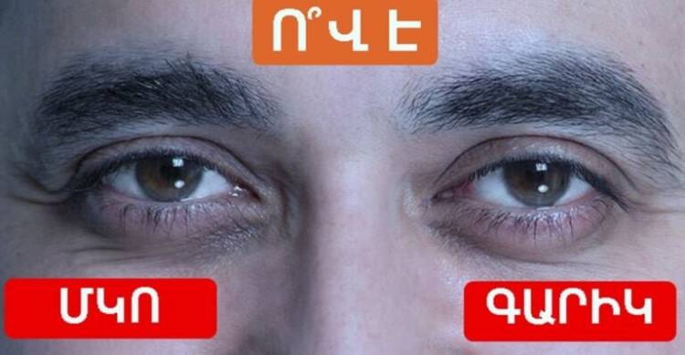 Թեստ. Կճանաչե՞ք հայտնի հայերին՝ նայելով միայն նրանց աչքերին