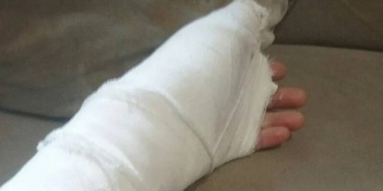 Քաղաքացին դիտողություն է արել անցորդին վատ պահվացքի համար. անցորդը կծել է նրա մատը, վերջինս մահացել է. ՌԴ