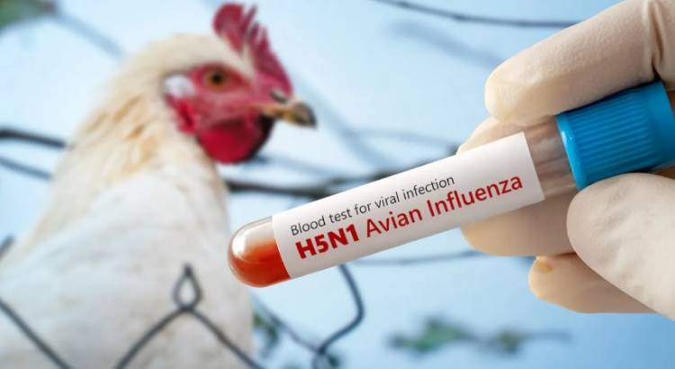 ԱՄՆ-ում գրանցվել է H5N1 թռչնագրիպից առաջին մաhը․ մանրամասներ