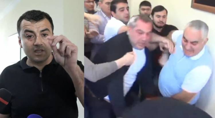 ՔԿ-ն փորձում է կոծկե՞լ Արթուր Չախոյանին ծեծելու գործն ու փրկել նախկին թաղապետին պատժից